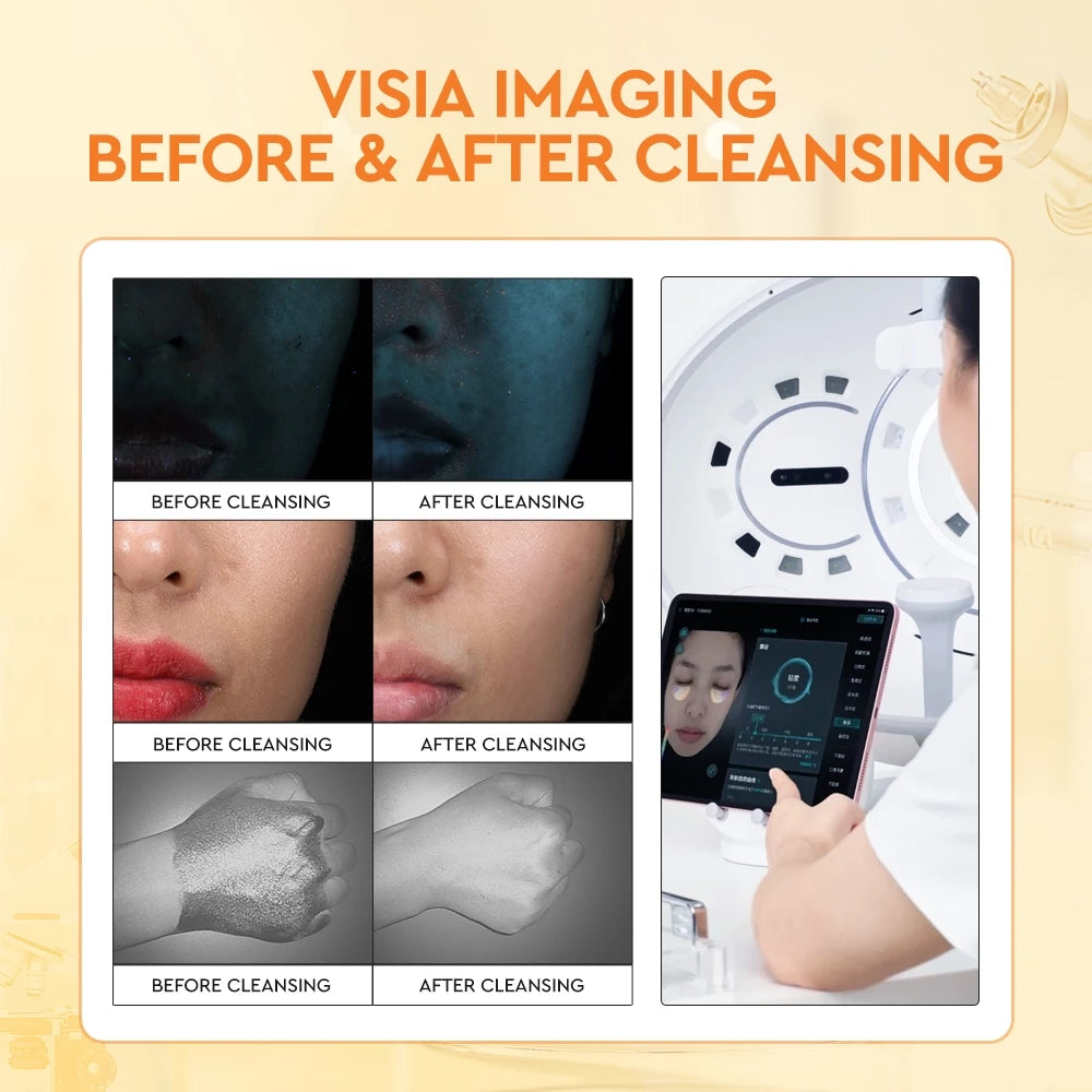 Salicylic Acid Deep Pore Cleansing Mousse