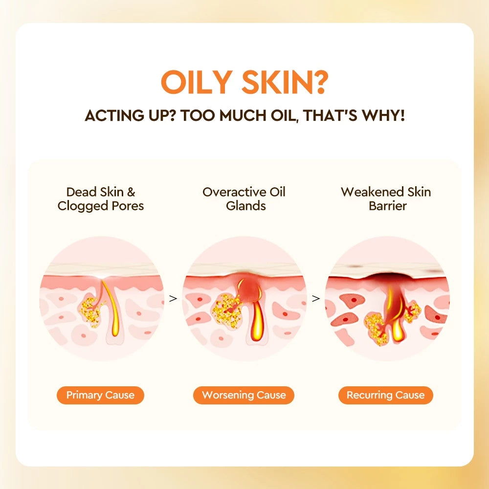 Salicylic Acid Skin Refining Spray Toner with Witch Hazel
