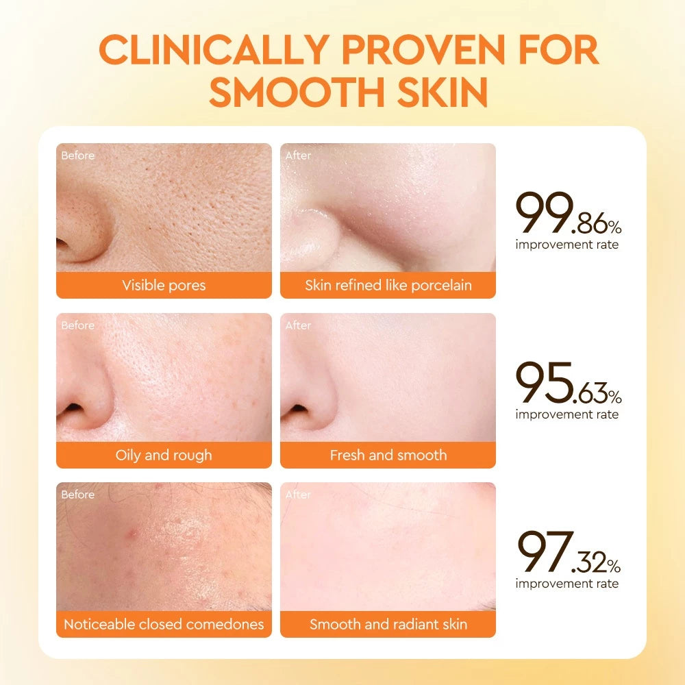 Salicylic Acid Skin Refining Spray Toner with Witch Hazel