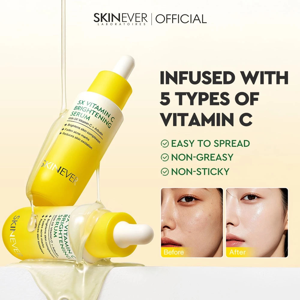 5X Vitamin C Instant Radiance Brightening Serum
