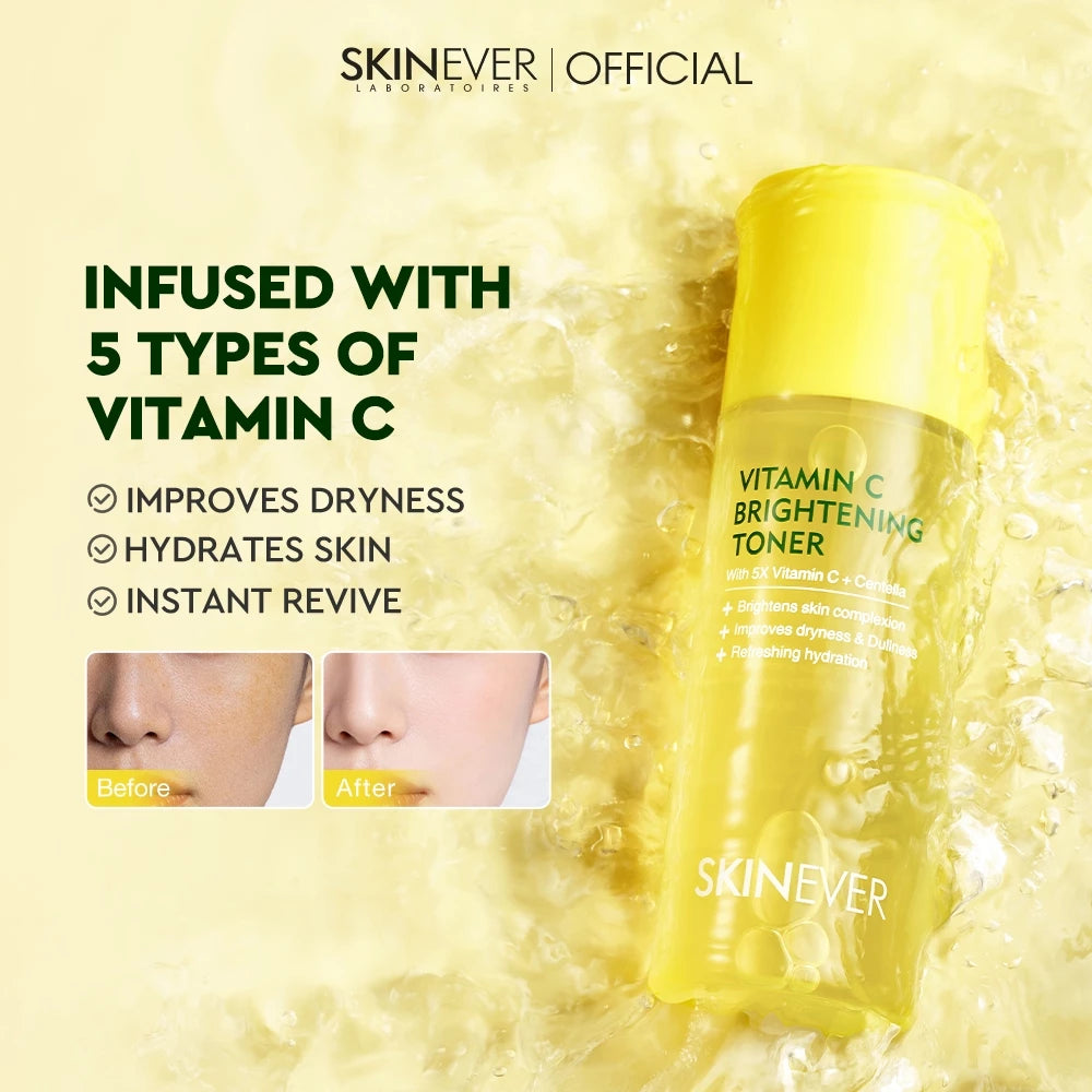 5X Vitamin C Refreshing Radiance Boosting Toner