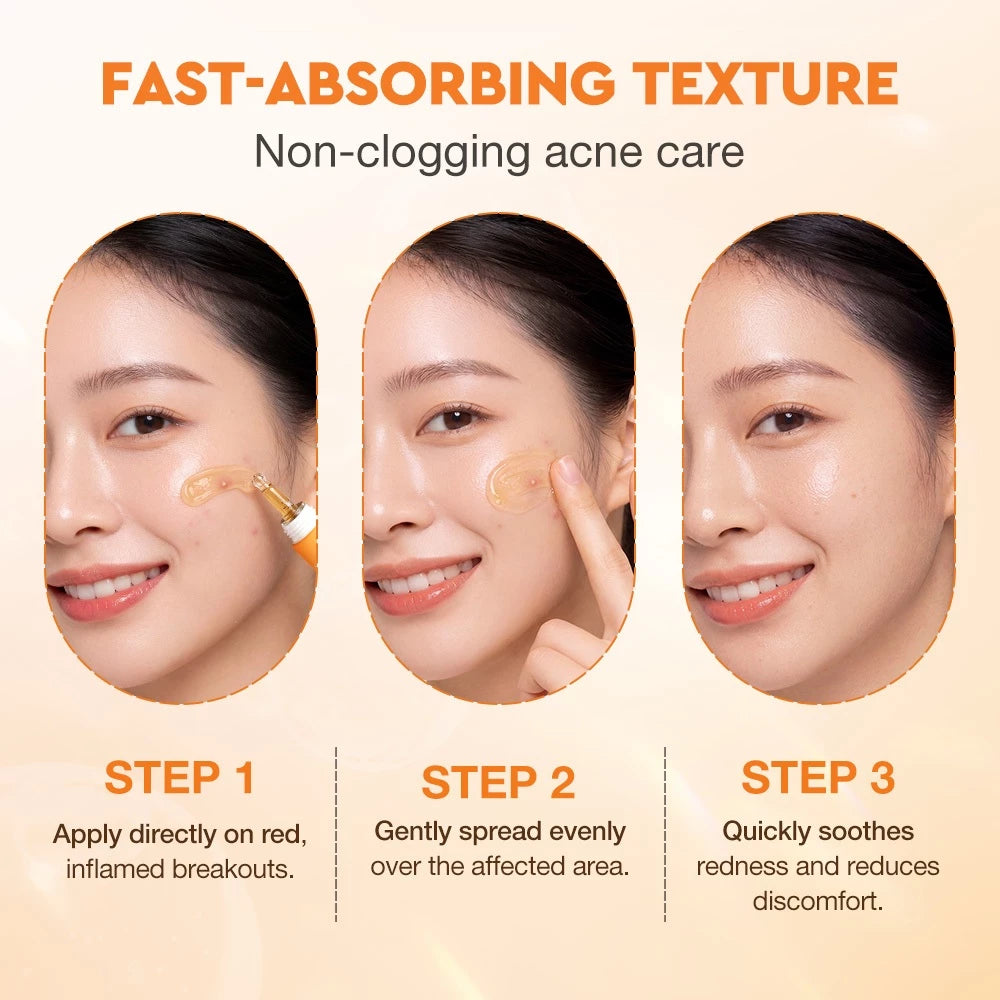 Salicylic Acid Rapid Repair Acne Fighting Gel Serum