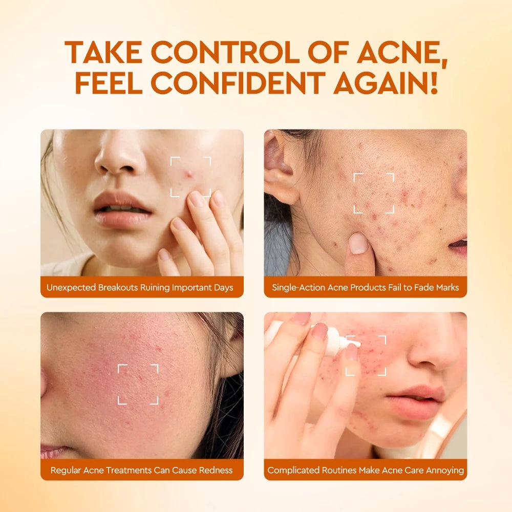Salicylic Acid BHA Acne Soothing Dual Action Serum