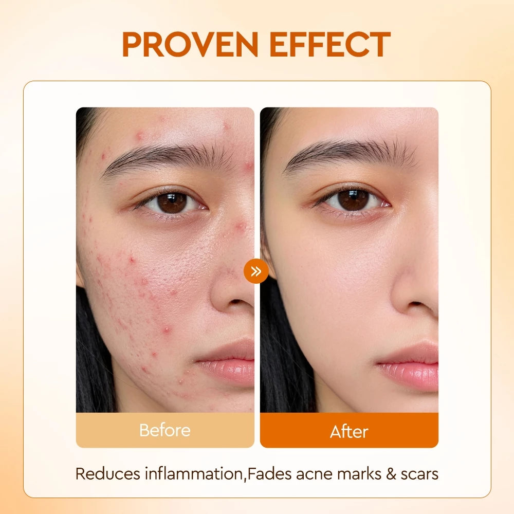 Salicylic Acid BHA Acne Soothing Dual Action Serum